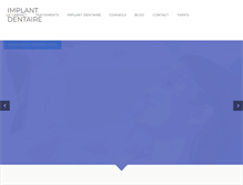 Tablet Screenshot of implant-dentaire-tunis.com